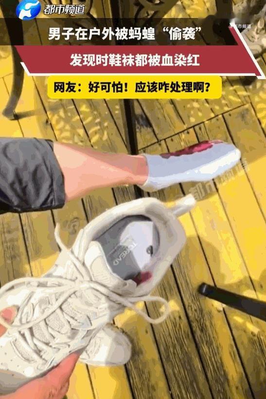 吓出一身冷汗！6月23日，云南，一名户外大哥进山徒步全程没察觉半点疼痛，中途坐下