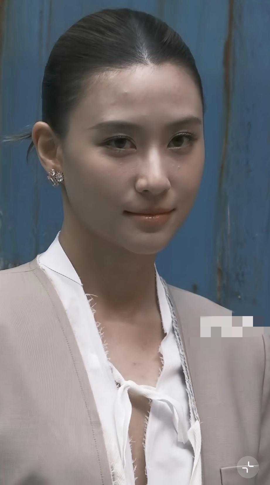 何超莲忙着参加活动，皮肤状态有点差了，她最近一次露面的怼脸拍显示皮肤油腻粗糙，额