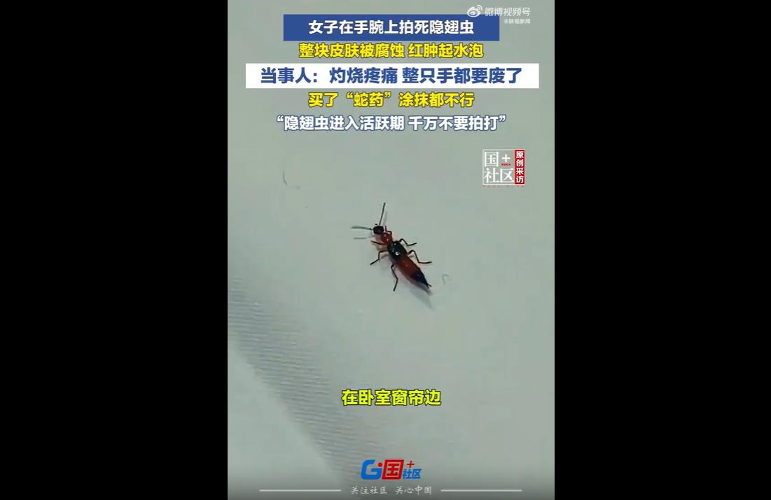 近日浙江义乌一名女子，手腕落上隐翅虫后随手徒手拍死，虫体破裂流出强酸性毒液，直接