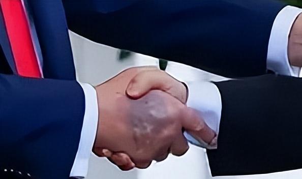 特朗普会见李在明，却被抓拍到手背一大片乌黑淤青！7月份还是小面积时，他还特意涂遮