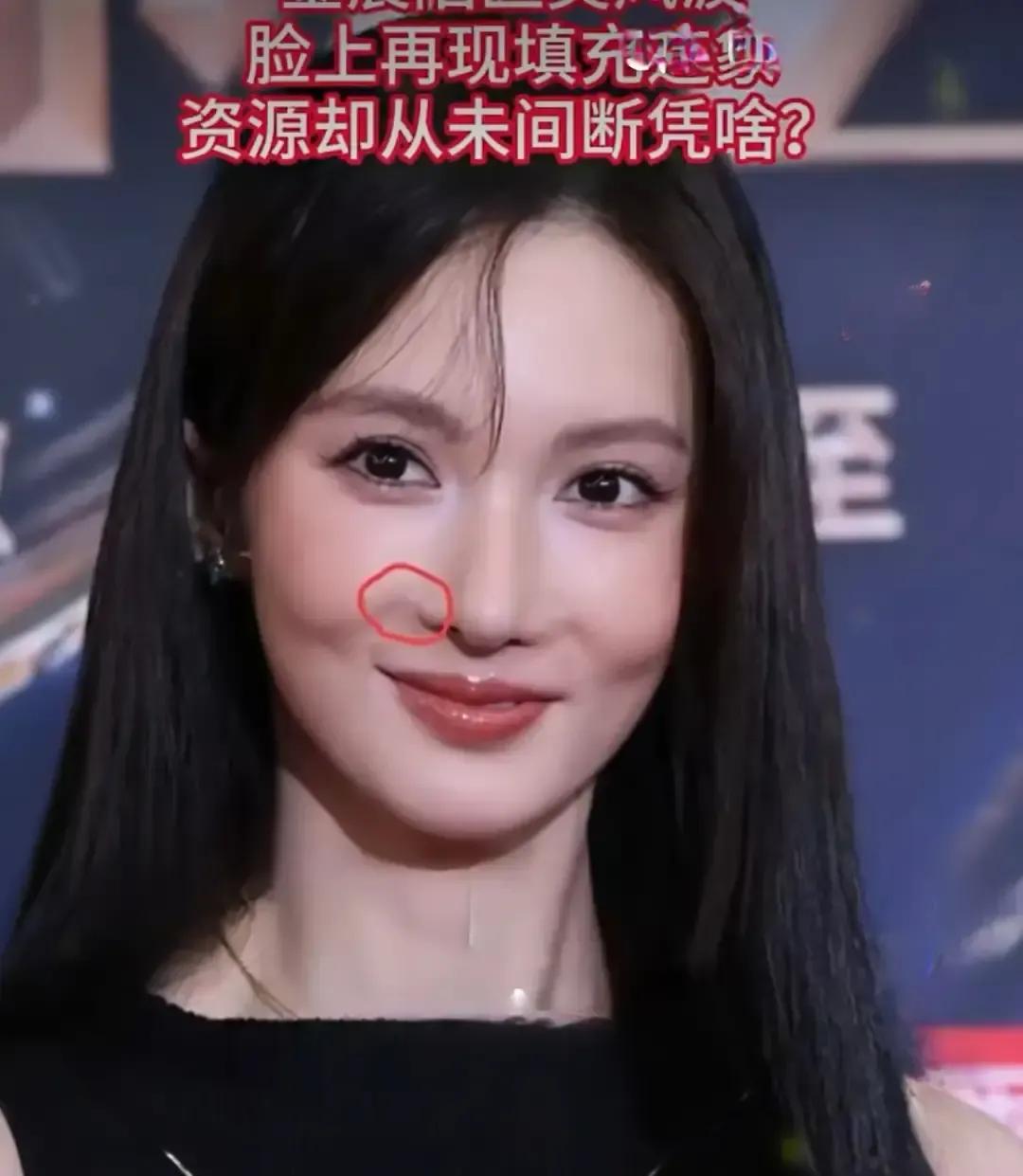 金晨在直播间被弹幕追着问是不是脸又动了，她直接笑场，说红毯那天化妆师手抖，高光打