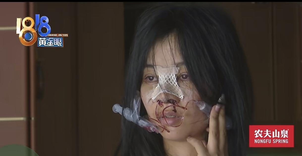 浙江杭州，一女子右手患血管瘤，治疗需要20多万，她为了挣钱治病，去一家KTV面试
