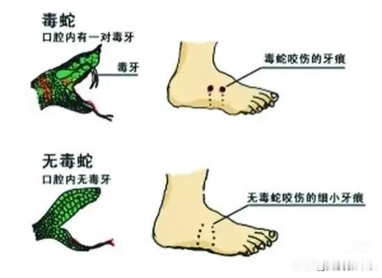 三亚游客被蛇咬，我们普通人要知道的事！三亚的蛇也是挺罕见的，大多数人遇到的概率