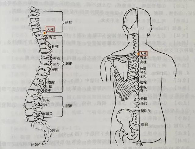 湿热体质, 最需要的是刮痧和拔罐!