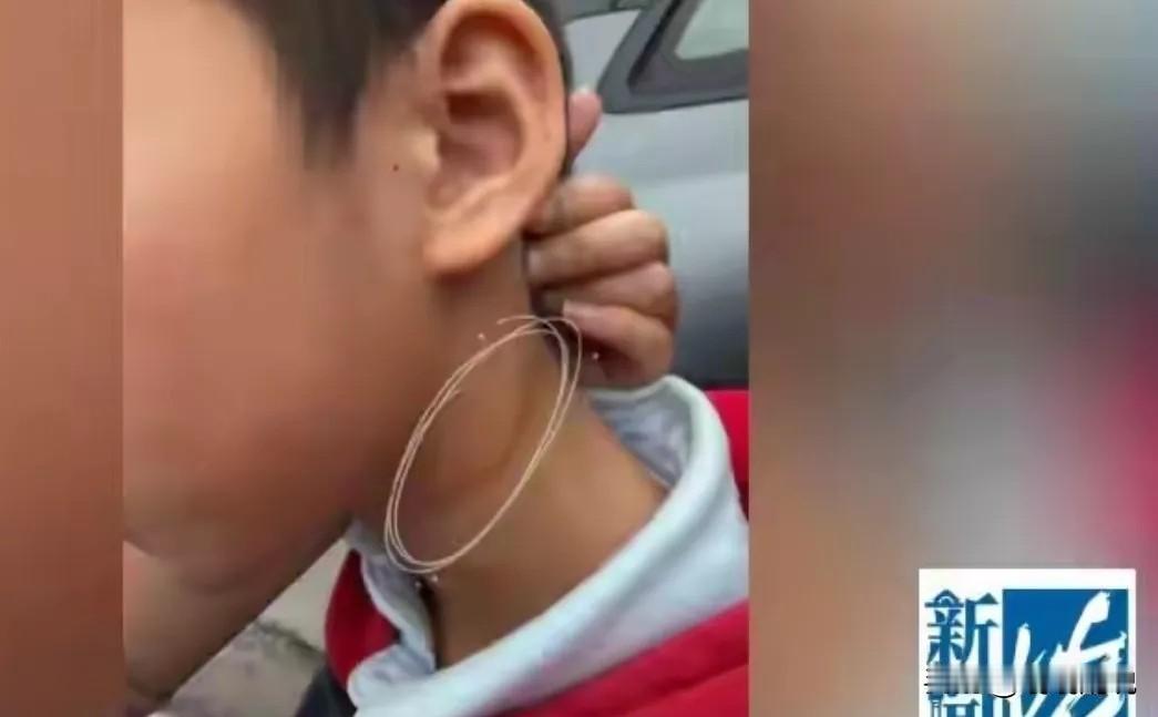 7岁娃看病怕检查，竟遭医生掐脖扇脸，院方态度更让人怒！谁能想到，带