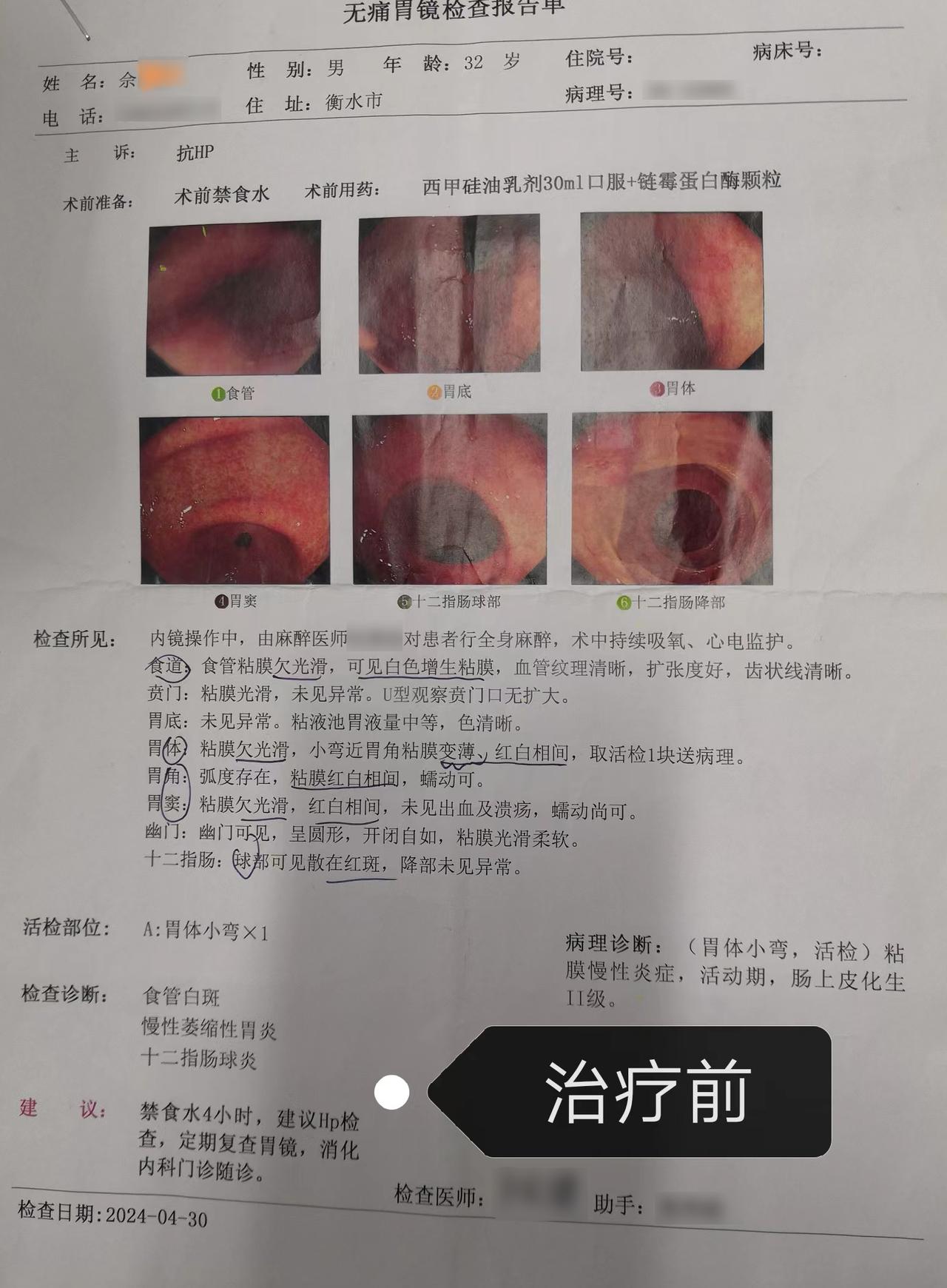 胃镜提示萎缩性胃炎伴肠化，180天好了90%！他的做法可以借鉴提醒：胃病不管