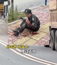 这也太吓人了！保安被恶犬扑倒，手臂被咬得稀巴烂！撕裂的伤口触目惊心，血肉模糊