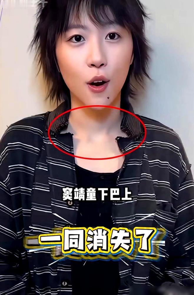 18岁的李嫣，终于和那道“豁口”彻底道别了。镜头里那张惊艳的脸，不仅是顶级医