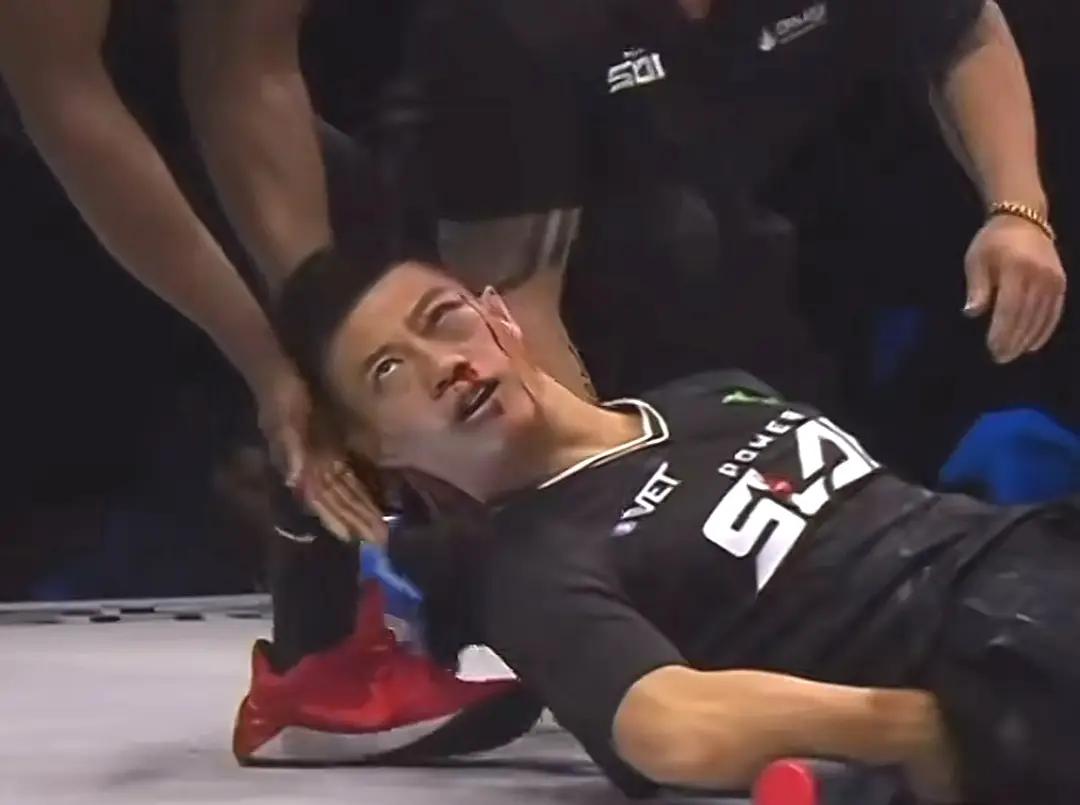 赵洪刚败北的主要原因，就是抗击打能力太差！通背拳传人赵洪刚在扇耳光大赛上被