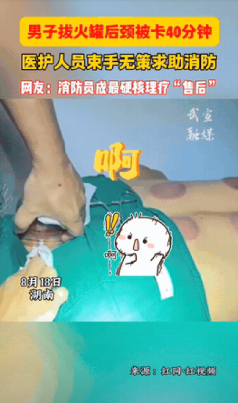 “这下悲剧了！”湖南长沙，一男子拔火罐取罐时，却发现罐子卡死在了脖子上，取都取不
