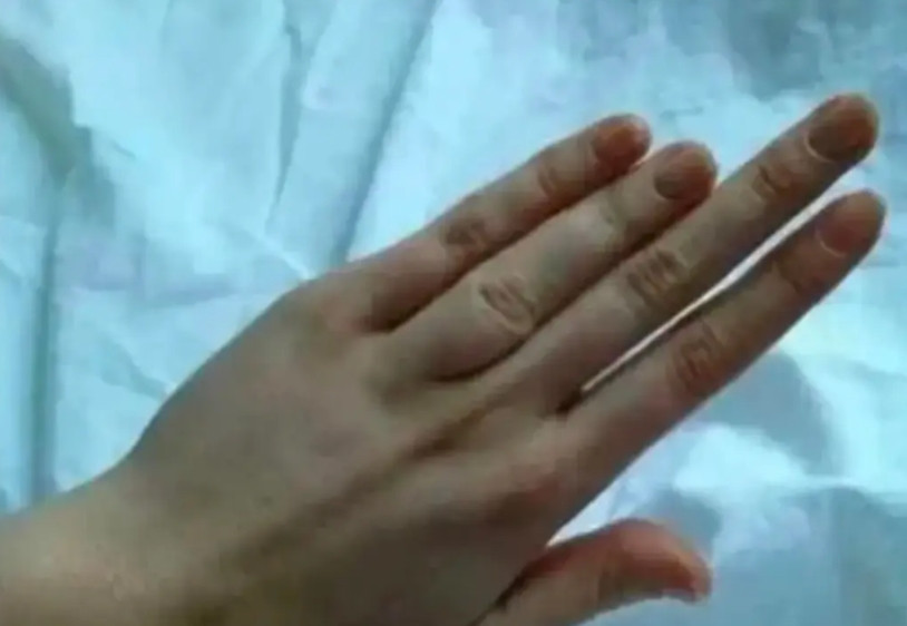 我的手型适合干什么？从小到大一直自卑，大家给出出主意，这个手型适合干什么？