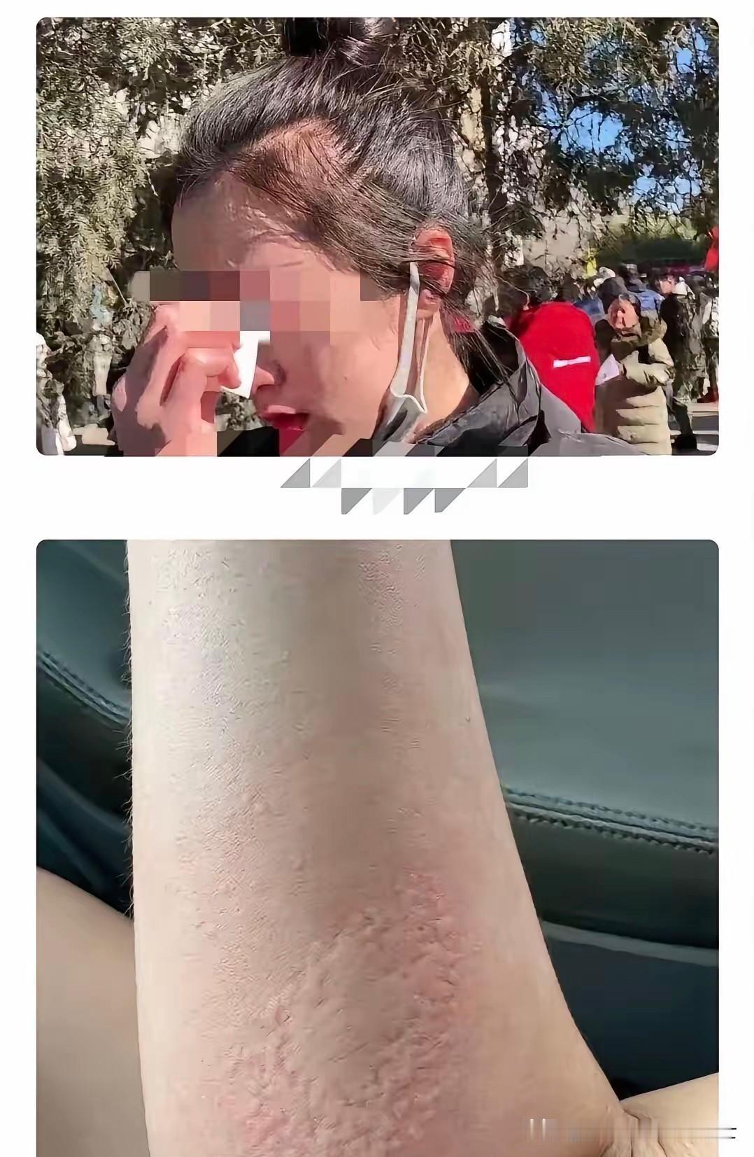 深圳一位二十六岁的姑娘，在网上跟外国男网友聊了没几天便约定了见面，在酒店待了整整