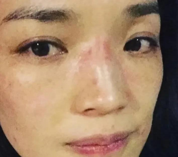 舒淇一个，还有吴建豪，这两个人经常过敏，这个应该就是免疫力低下的结果，要不然