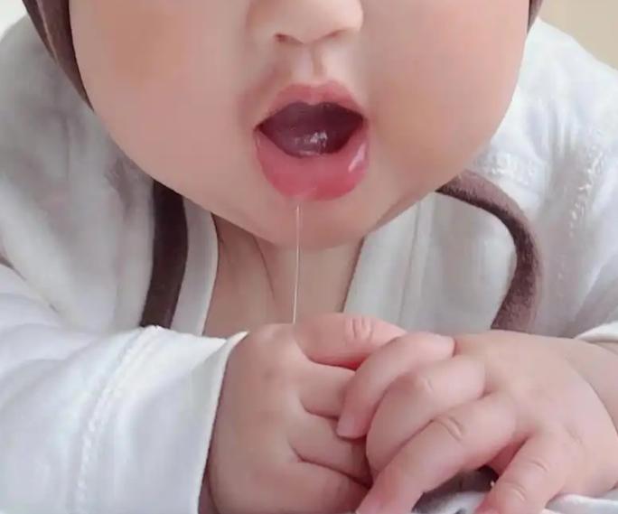 流口水是怎么回事？小孩流口水是正常，因为脾常不足，什么叫脾常不足？意思就是小