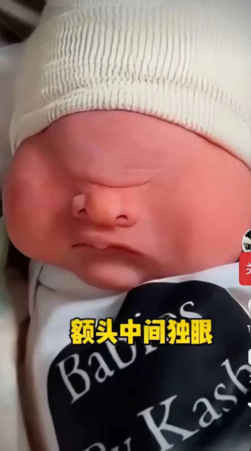 山海经真的不欺人，现实里真的有独眼人。近日，有一个网友晒出了自己的孩子，竟然是