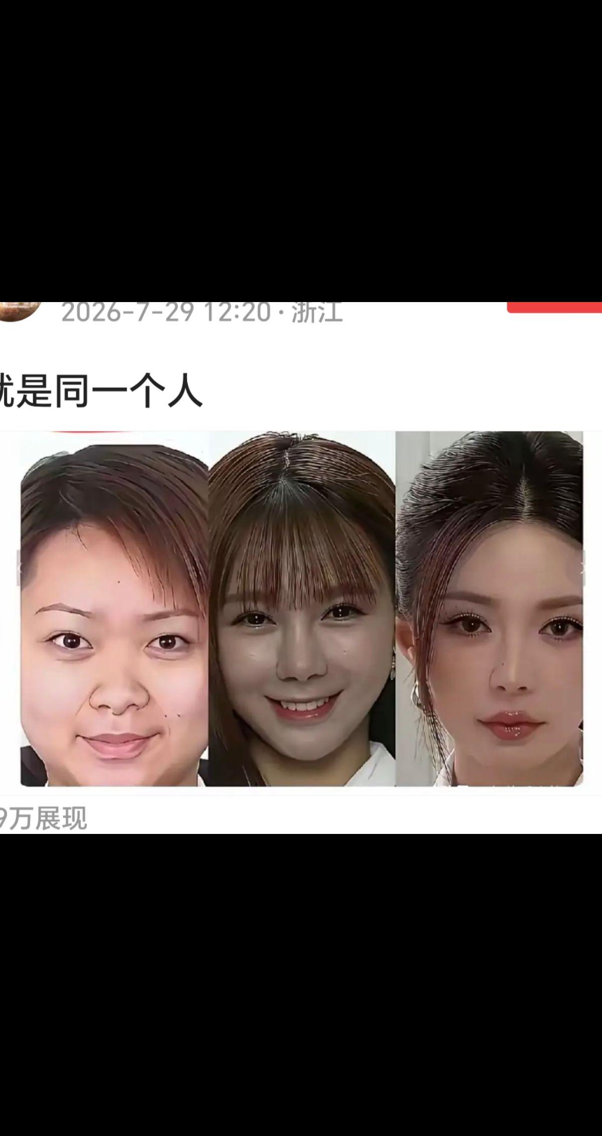 阴阳怪气的，不就想说人家整容了么？整容怎么了！我觉得现在的沈梦辰挺美的啊！爱美是
