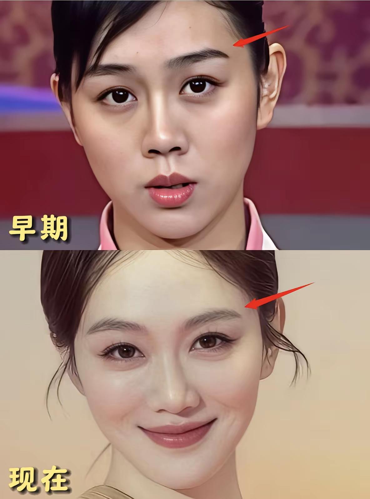 脸上是否有变化，交给大家去评判吧，
