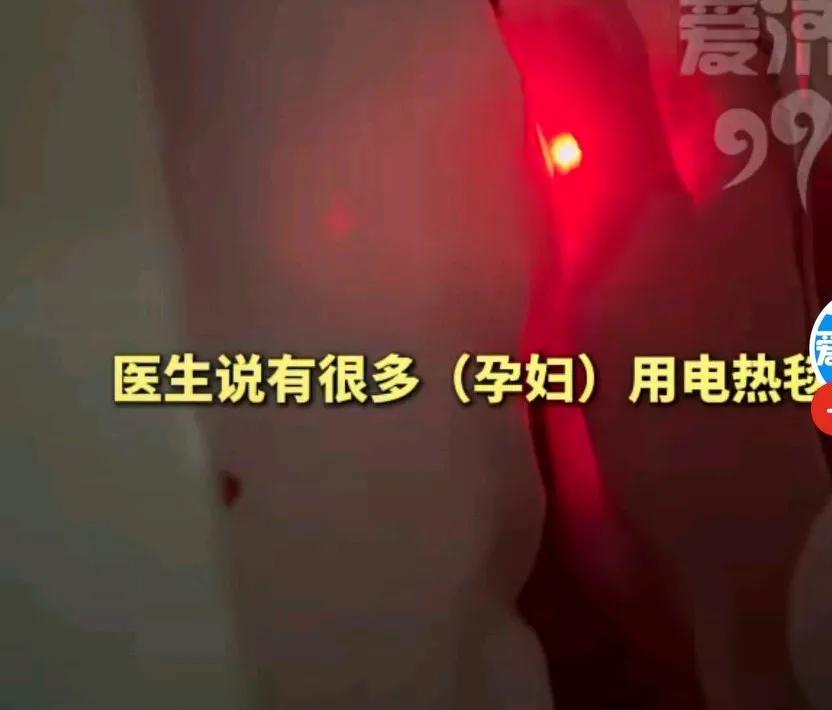 女子孕早期使用电热毯差点出意外，她说肚子疼的厉害，去医院检查，医生说子宫内出现