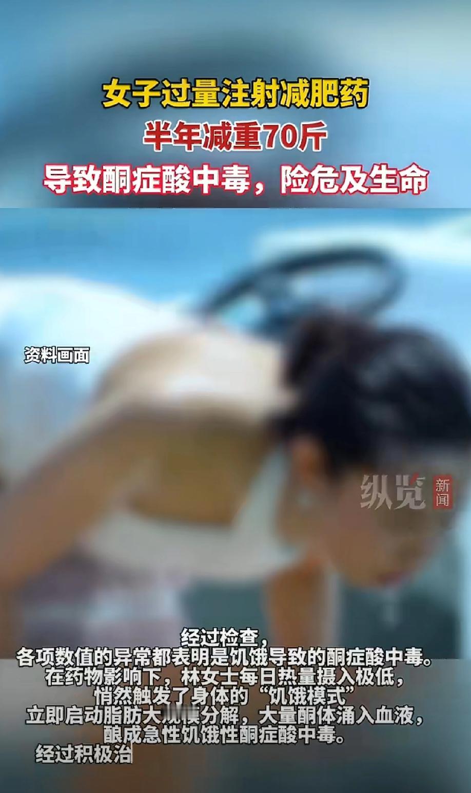 太惊心了！浙江林女士为了快速瘦下来，自行注射网红减肥药，半年内从160斤猛降到9