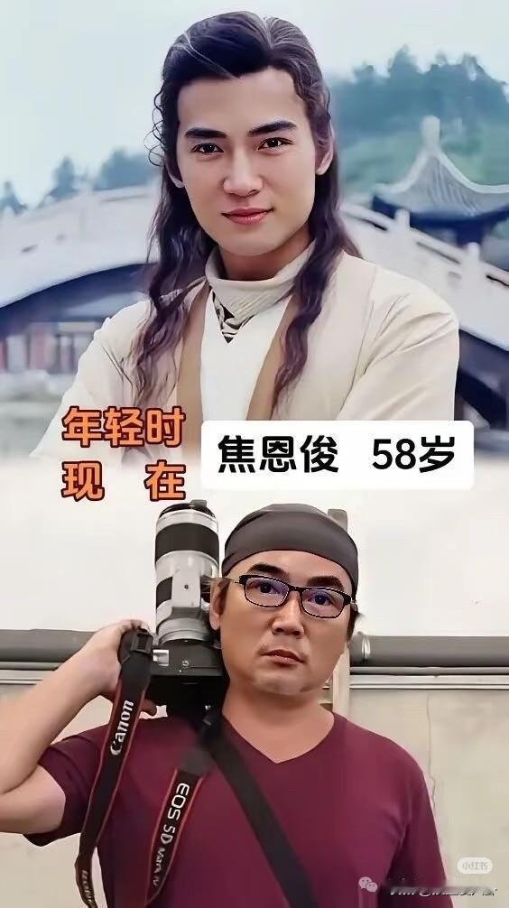 这就是顶级帅哥的超绝心态吗？曾经帅到无敌，所以对容貌不屑一顾现在的小李飞刀焦