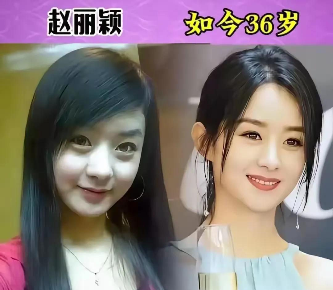 我刷着手机，扭头问老公：“你看赵丽颖以前是不是像工厂女工？明星出道前后变化也太大