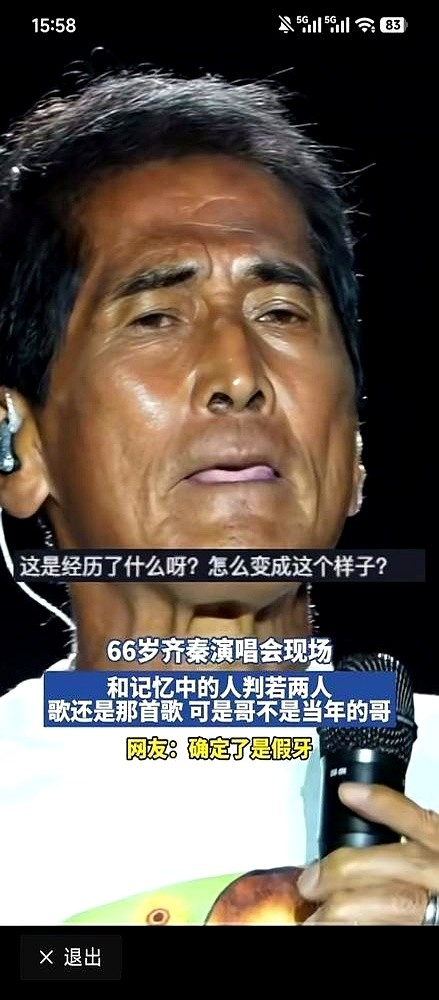 64岁的齐秦，一张嘴，牙没了。网上全在传他肺癌晚期，瘦到脱相，话都说不利索。结果真相就俩字：槟榔。嚼