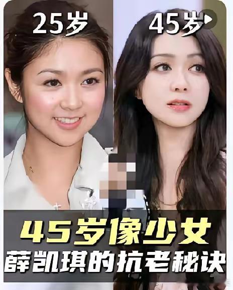 薛凯琪45岁了，还像少女。没有结婚生过，没有怀过孕，真的不像妇女，也不像人妻。不