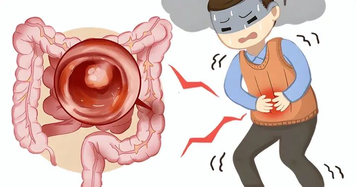 一周至少15次! 44岁男子癌症晚期, 医生: 强调多次, 就是不改