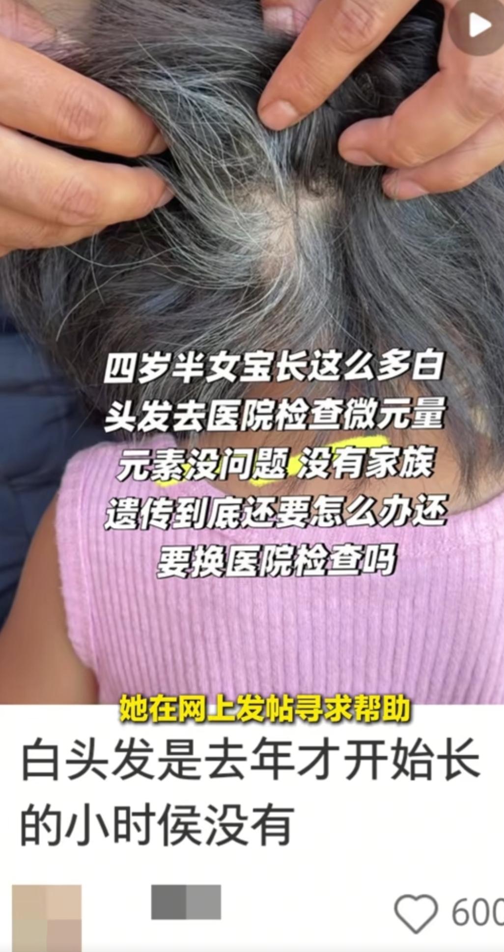 近日，贵州一位宝妈上网求助，自己4岁的闺女竟长出一头白发！跑遍医院都查不出病因，