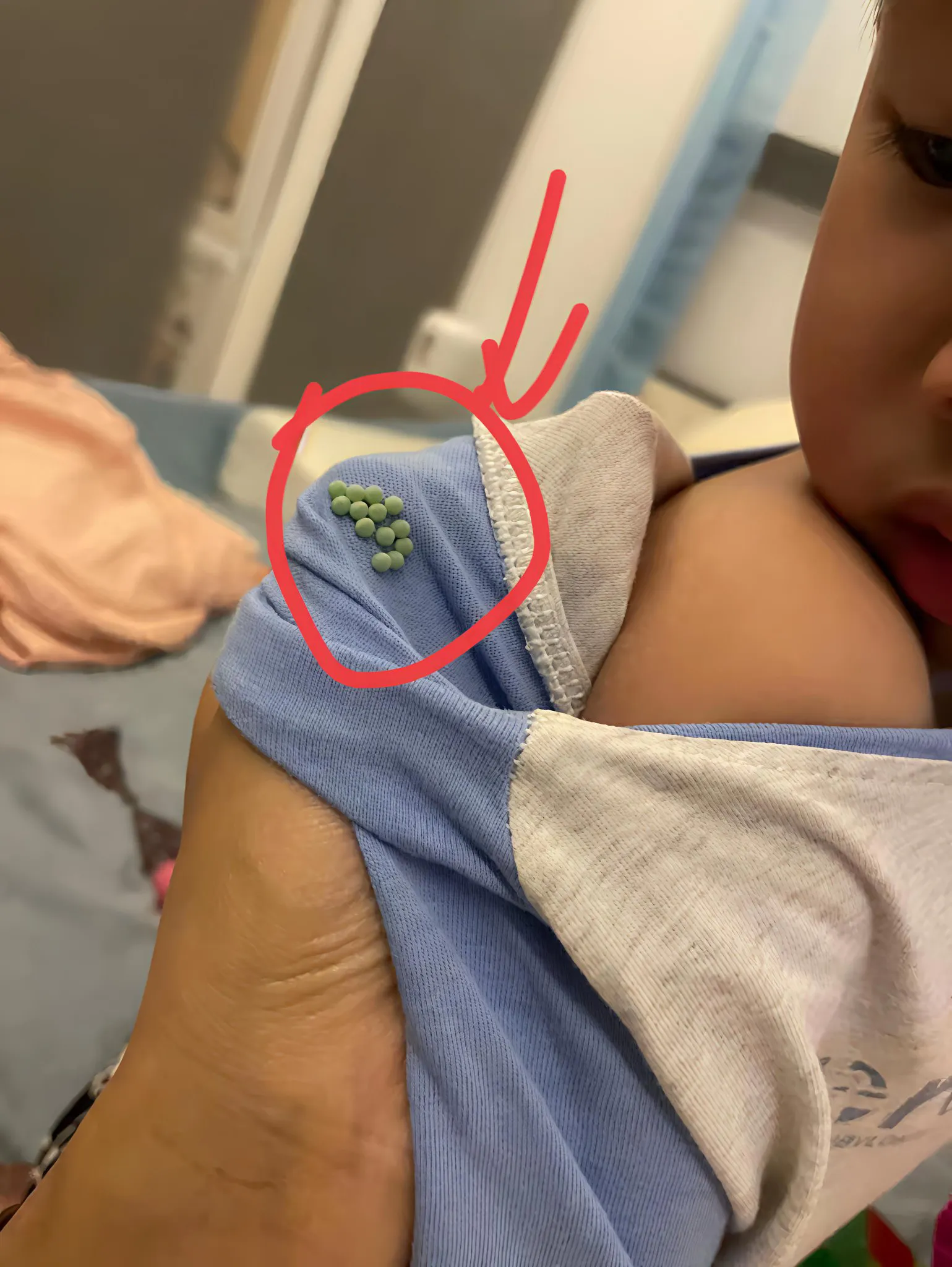 为什么小孩的衣服上会长这种虫蛋