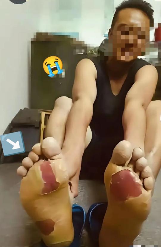 九三阅兵的战士归来，当众人看到他的双脚我瞬间泪目了！ 9月3日，那场纪念中国