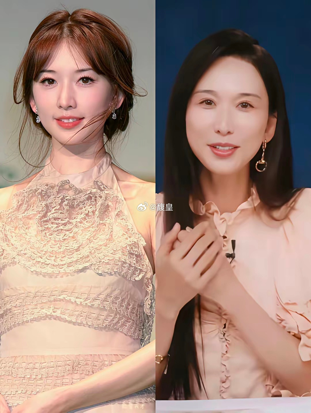 谁能想到这是林志玲。眼窝凹陷，发际线往后移。女神也逃不过岁月。​​​