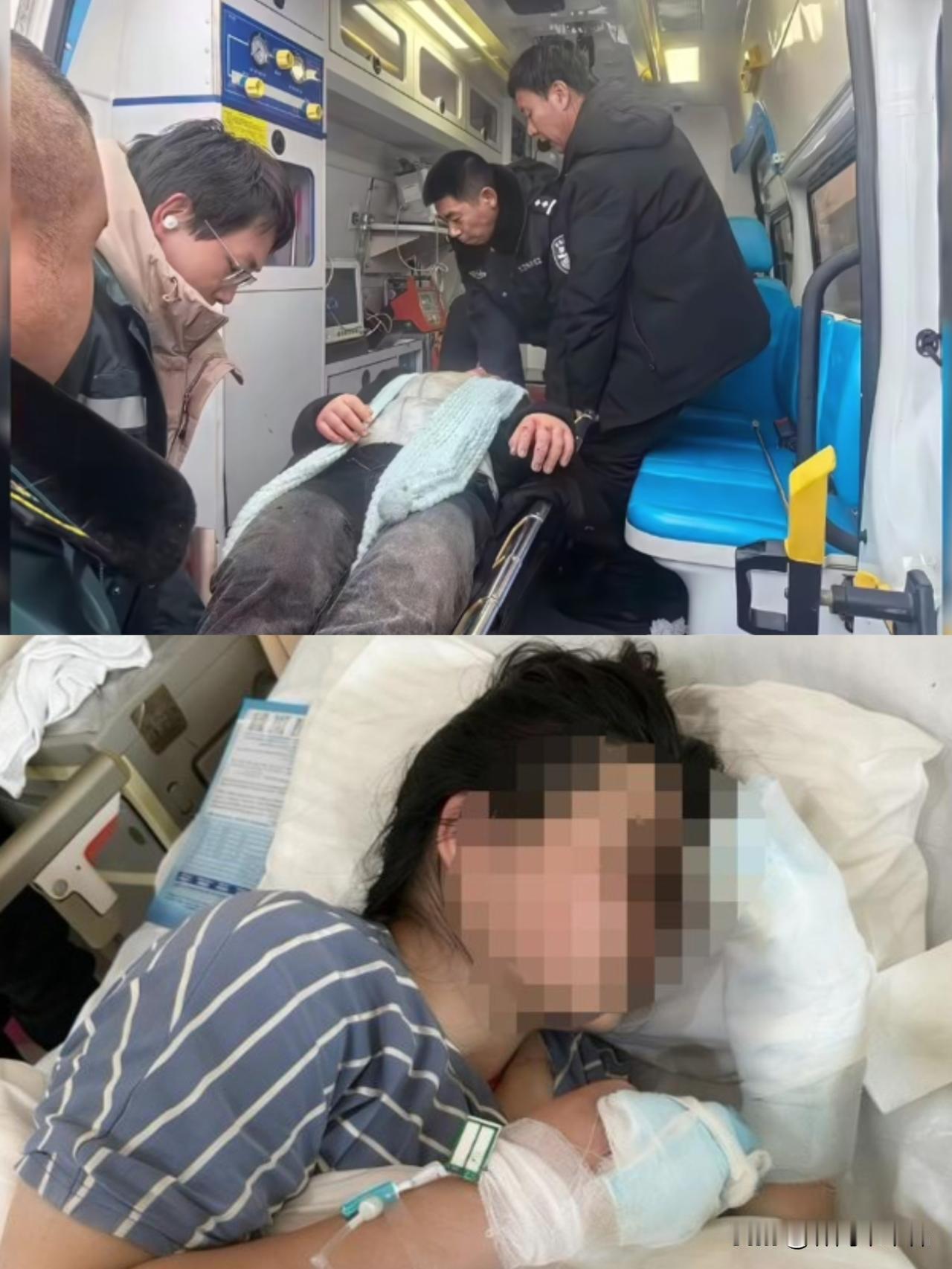 学音乐的21岁四川女孩，独自去黑龙江旅游被冻伤，3根手指预计要被截肢，父亲发起了