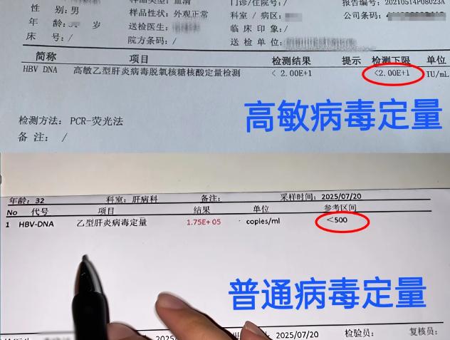 花几百块查乙肝病毒高敏检测值不值！对于乙肝患者来说，几百块的高敏检测，不