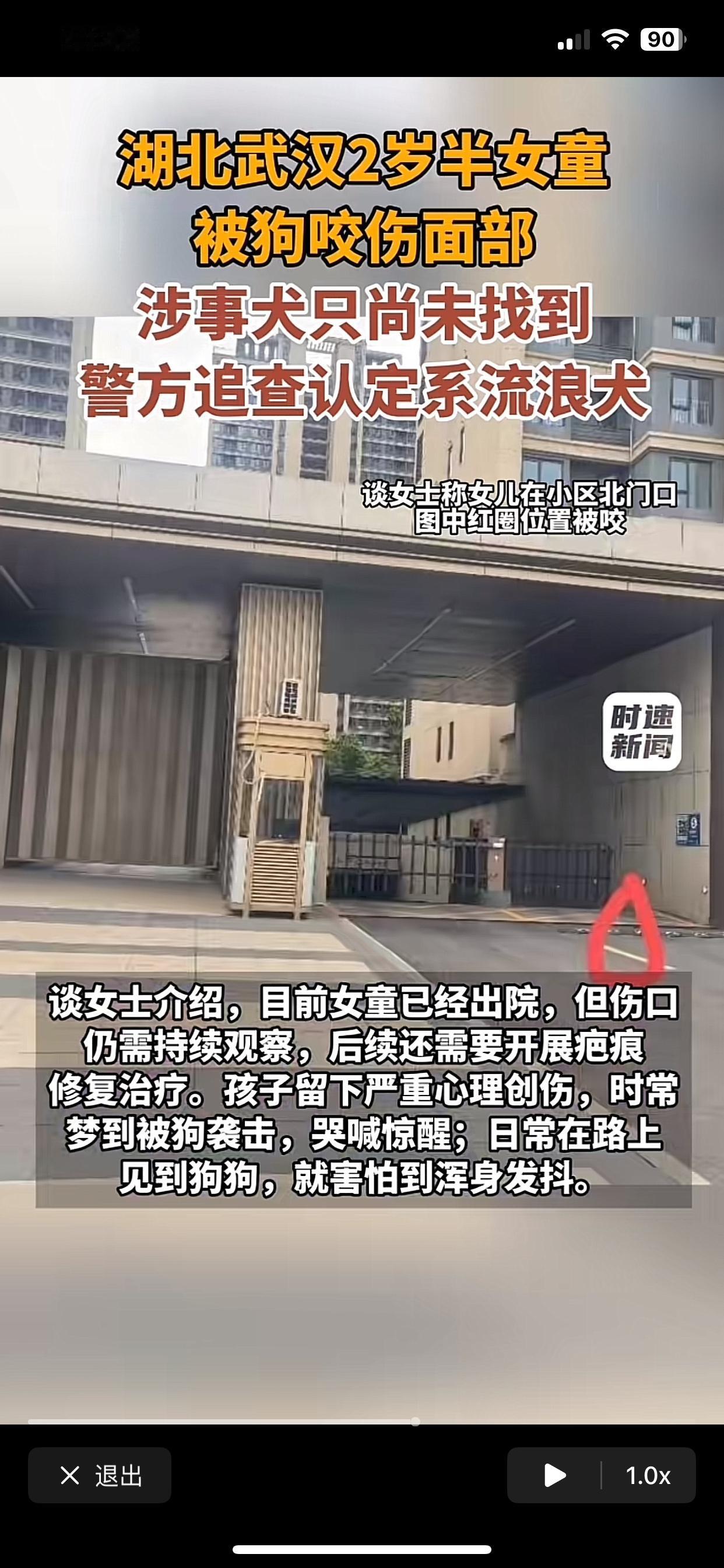 保安清理流浪狗：动保、爱心人士全面发声流浪狗咬伤儿童：动保、爱心人士一片寂静