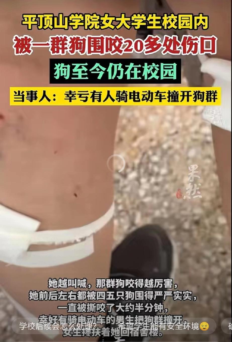 “解释不清”！河南平顶山学院，一女大学生在校园里正常走路，谁知，突然窜出来四五条