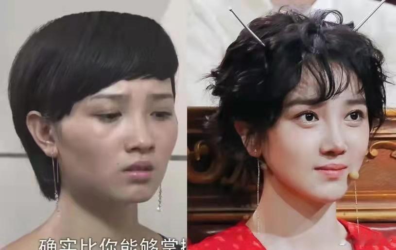 整骨十次的陈小纭疑似再动脸，阿那亚被偶遇，卧蚕怪异憔悴！​​​