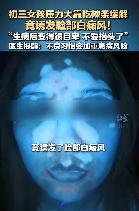 “悲剧还是发生了！”近日报道，河南郑州，一初三女生因为升学压力大，便经常靠吃辣条