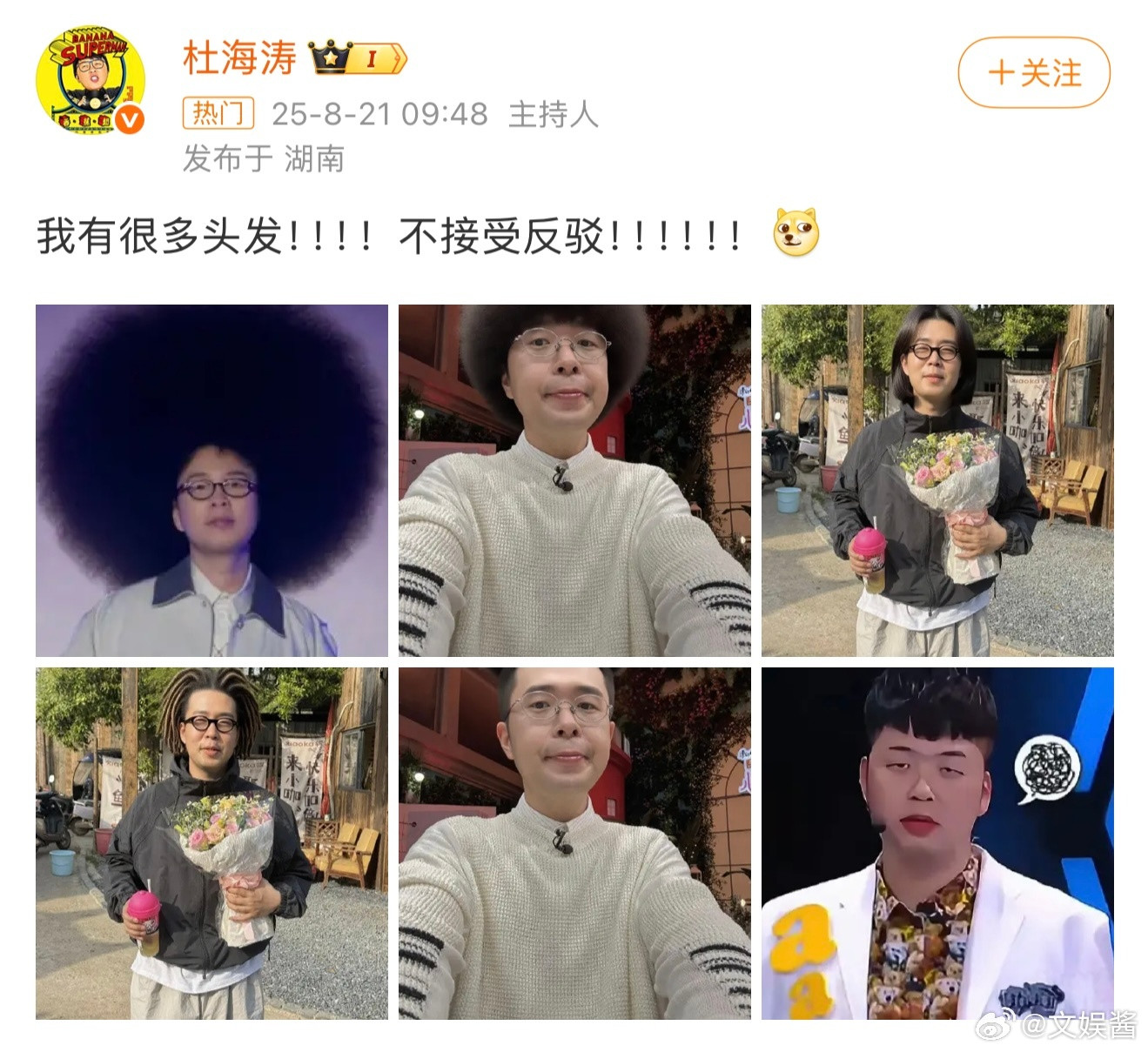 杜海涛回应疑似脱发杜海涛发文回应疑似脱发，晒出几张照片称自己有很多头发！！！不接