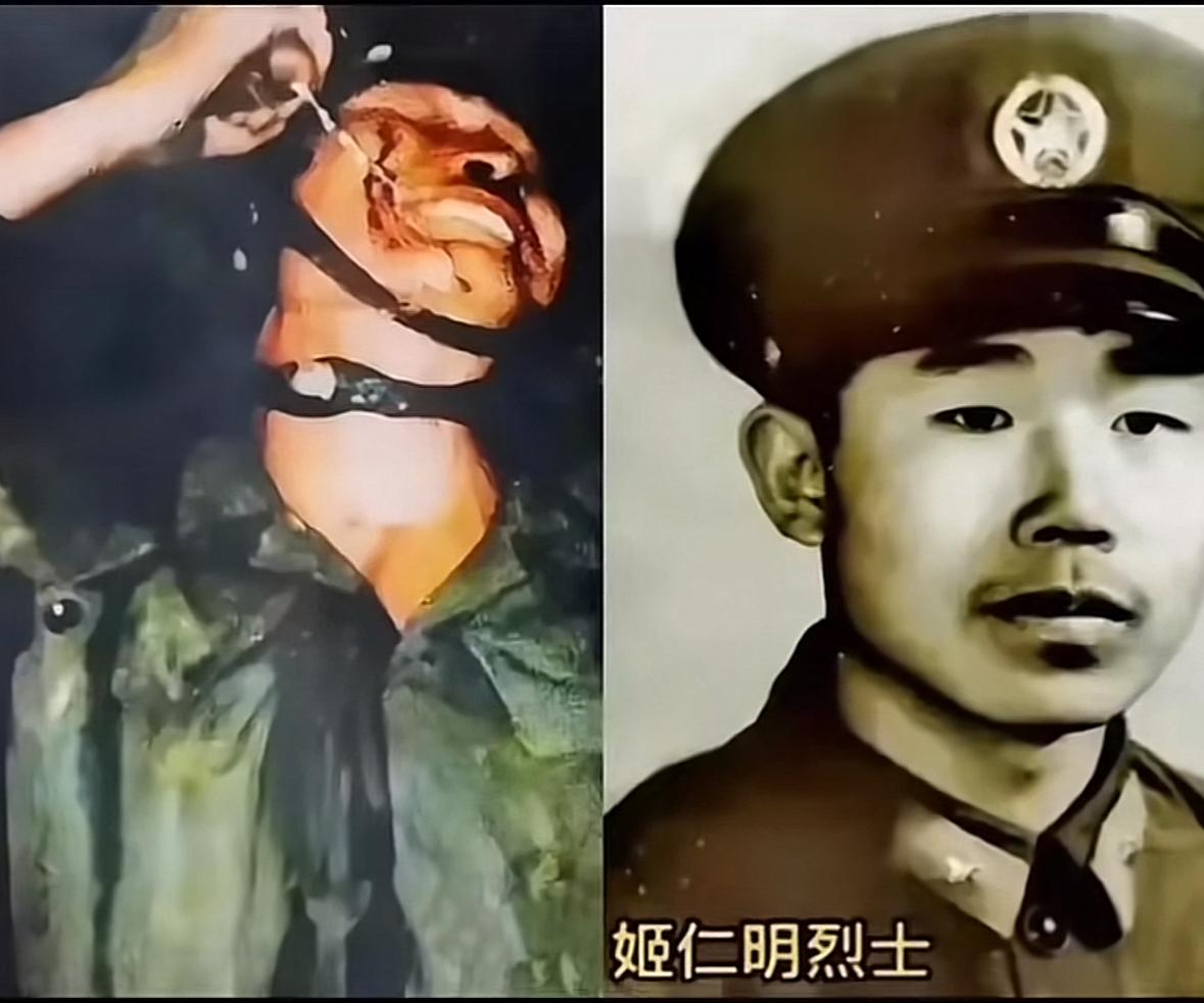 老山英雄姬仁明，右手受伤严重不能动弹，倒地前，他拼尽全力拉响了最后一颗手榴弹引线