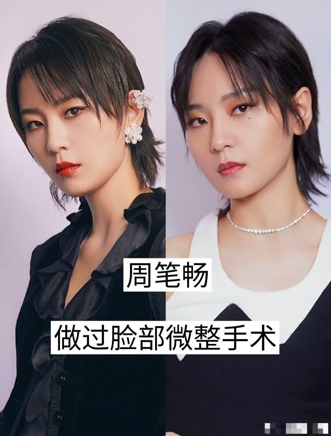 承认自己整过容的明星