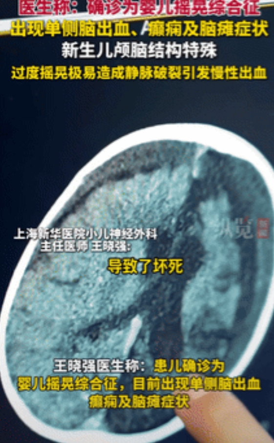“悲剧还是发生了！”上海一新手爸爸为哄娃，把孩子抱在怀里摇晃，放回床上后，孩子突