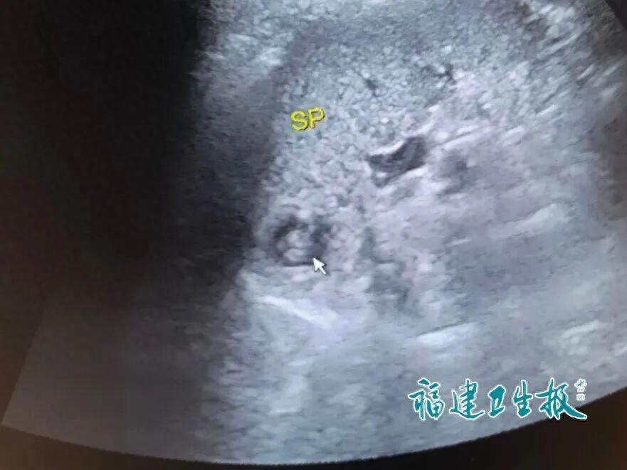 世界之大无奇不有！福建福州，一35岁女子停经后血检指标明确显示怀孕，可跑遍多家医