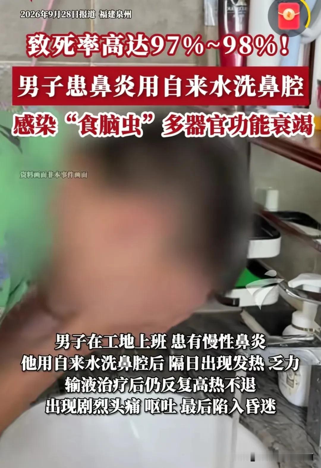 原来鼻炎患者不能直接用自来水洗鼻子啊！刚刚在忙网上刷到的一个新闻，说某个患有鼻