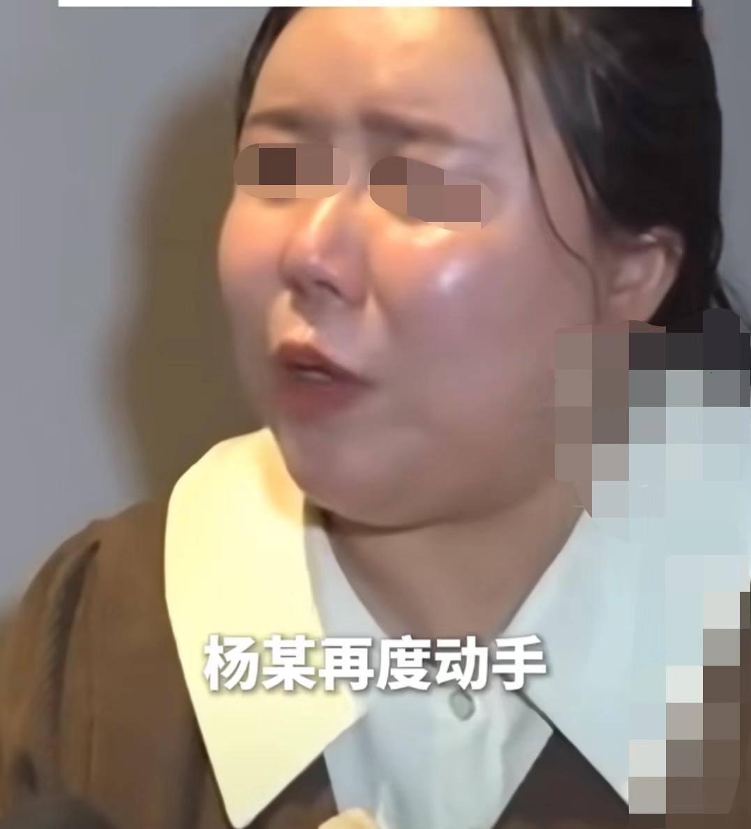 北京独生女被男友殴打残疾案终于开庭了！这个女的真的是恋爱脑啊，到现在竟然心