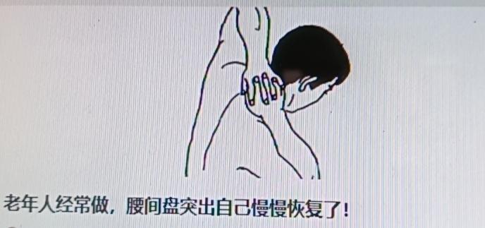老人腰间盘突出想慢慢恢复，有些动作或许有用，但可别瞎练。像网上流传每天吊单杠1