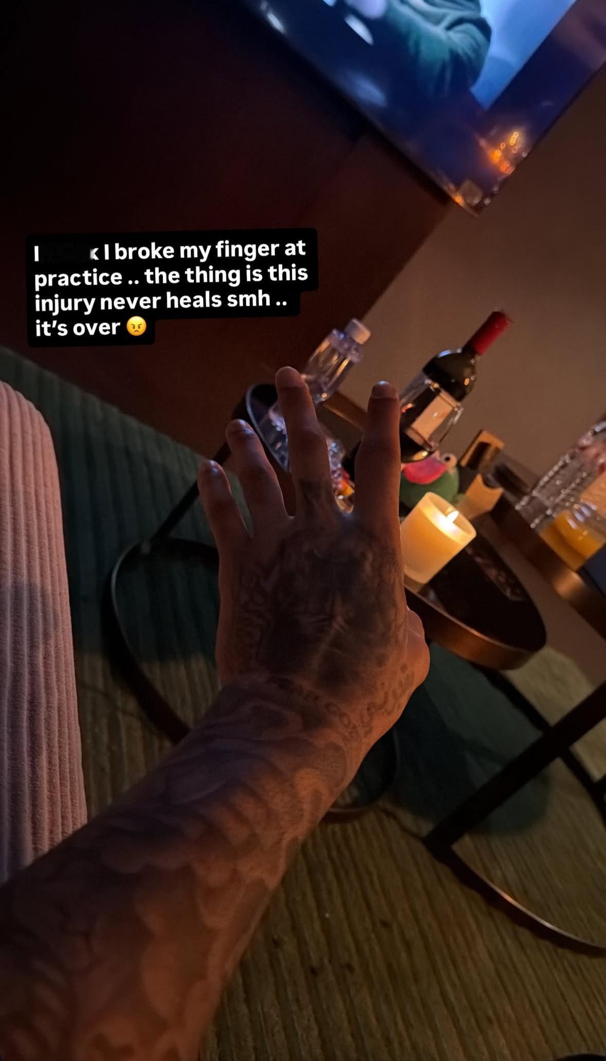 莫兰德更新insstory左手食指在训练时“吃了萝卜干”肿了好大莫兰德说：