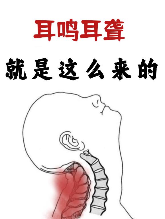 人体自带“止鸣穴”