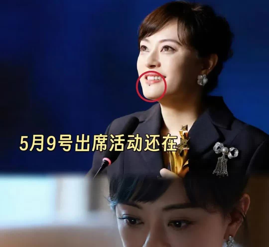 我怀疑孙俪把痣切了不是因为担心影响颜值，毕竟脖子上的扁平疣她都没管，很有