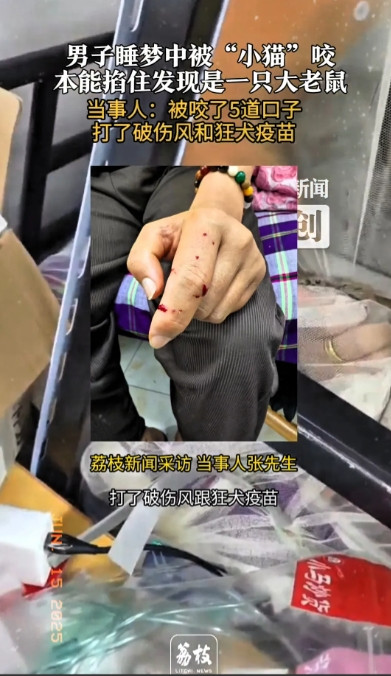 “太悲剧了！”江苏无锡，男子睡觉时，感觉手上有东西在爬，他误以为是养的猫，直接将